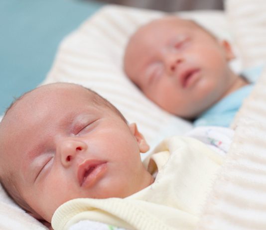 In Brasilien sind Zwillinge zur Welt gekommen, die Halbgeschwister sind.
