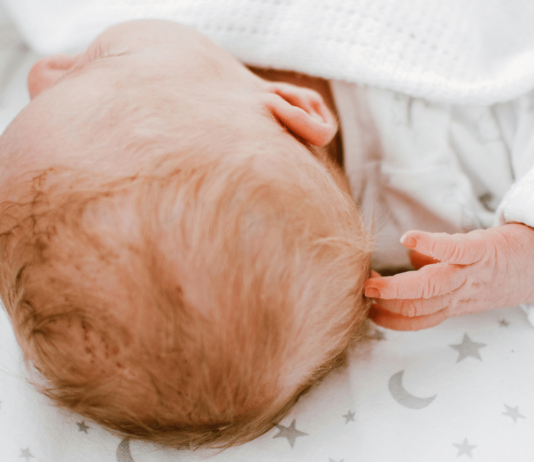 Baby liegt auf einer Decke, vordergründig ist der Kopf mit Kopfgneis zu sehen. Das Baby kratzt sich.