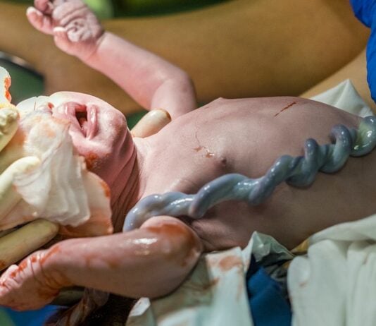 Ein Nabelschnurvorfall kann für das Baby lebensgefährlich werden.