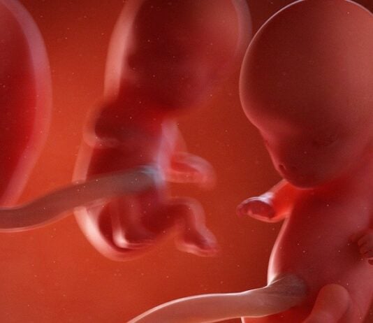 In der 10. SSW hat dein Baby etwa die Größe einer Kirsche oder Erdbeere. Grafik: Bigstock